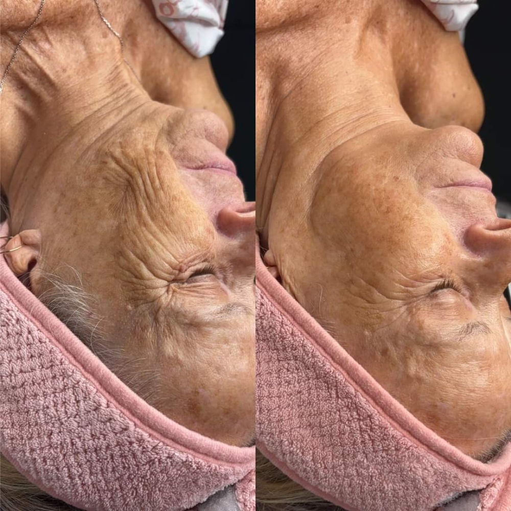 Luxe Lift Facial