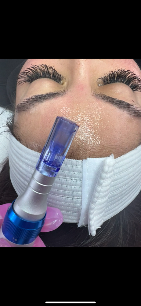Nano Needling