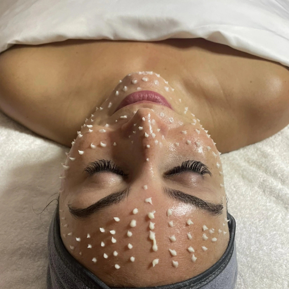 Liquid Microneedling at Mind,Body,And Skin in Tracy, CA