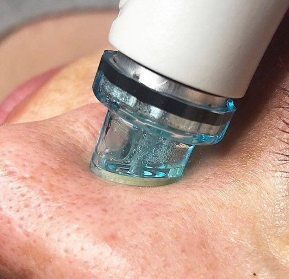 HydraBrasion Facial.