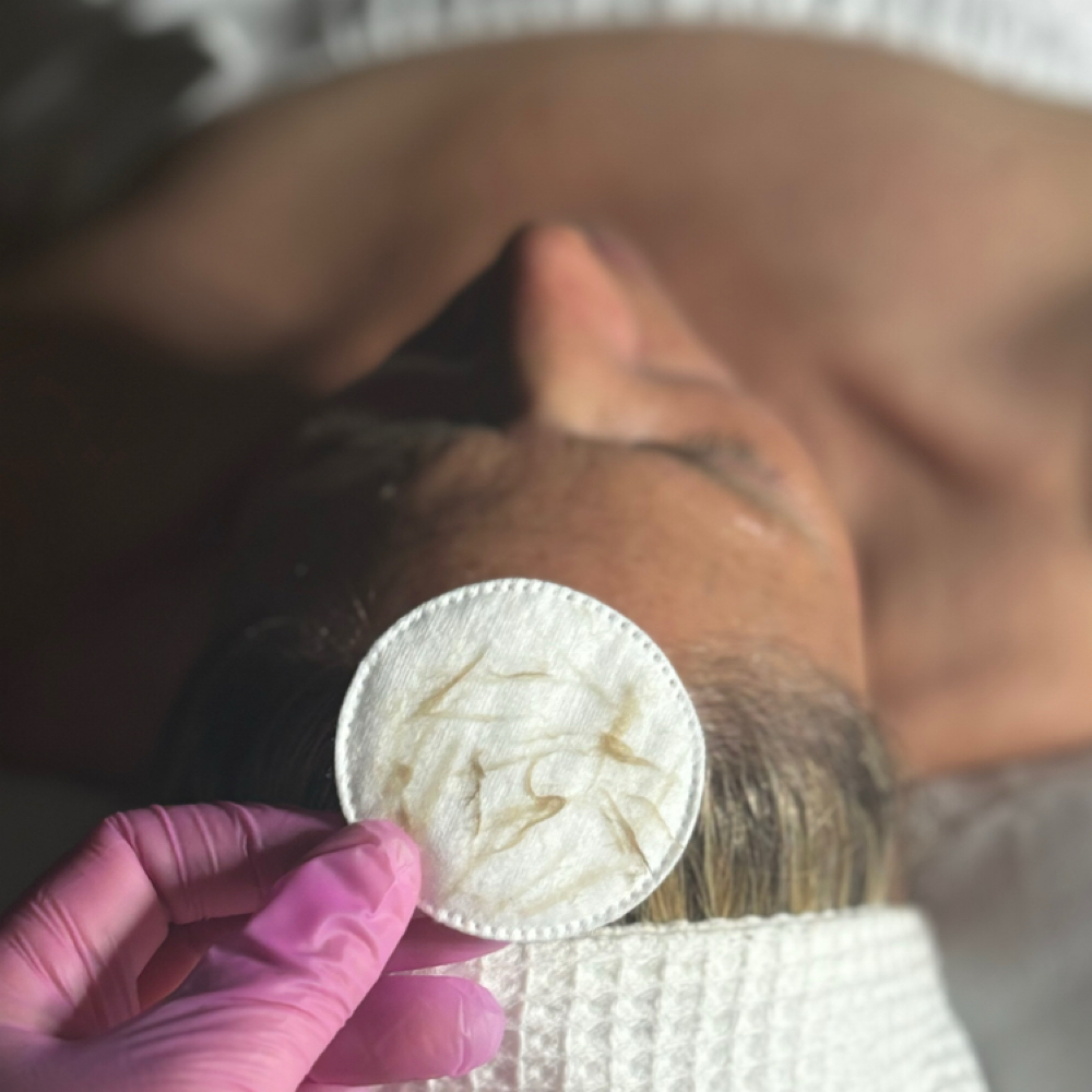 Dermaplane at Skin Works by Katy in Goldsboro, NC