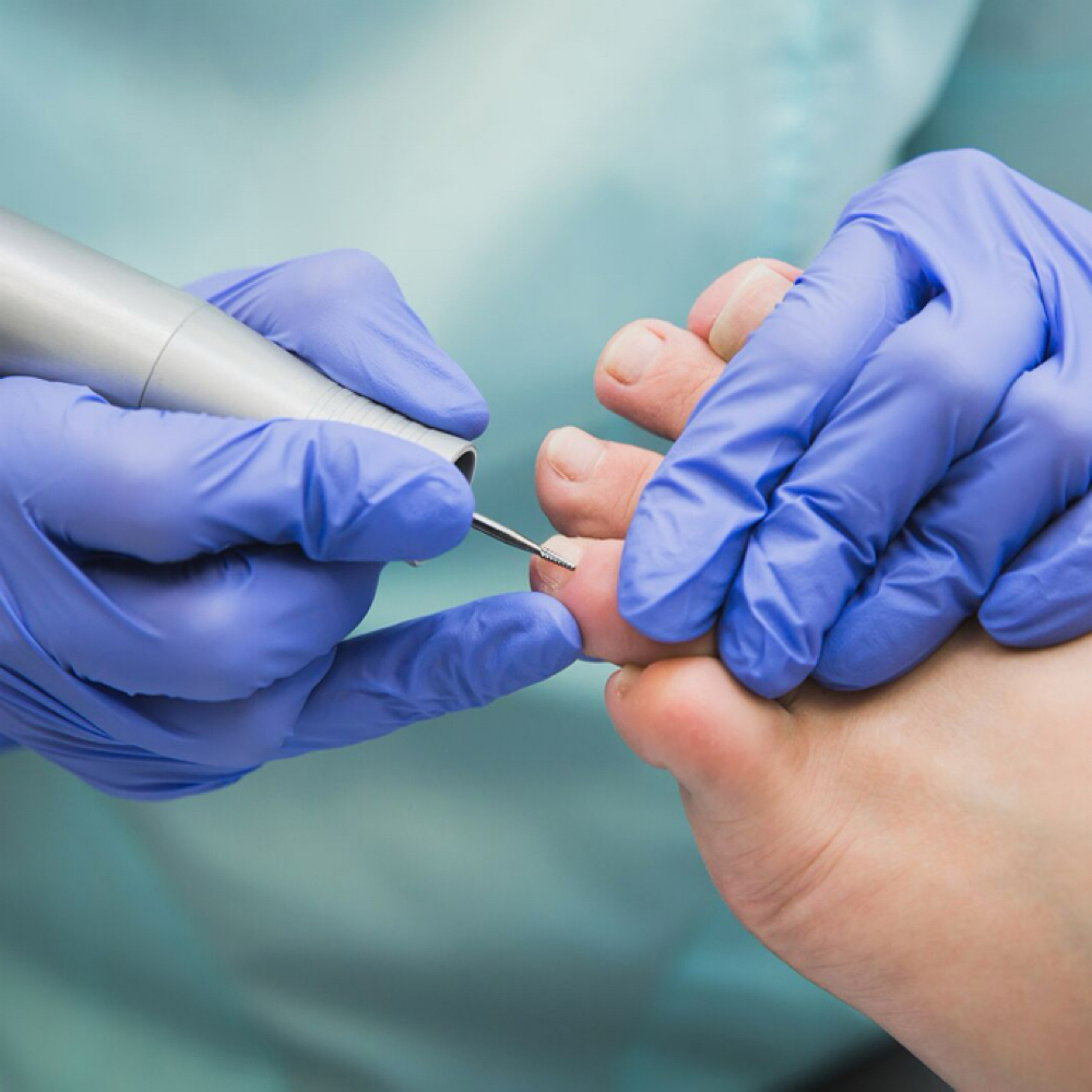 Heel to Toe Foot Wellness Treatment at Meraki FootCare in Dayton, OH