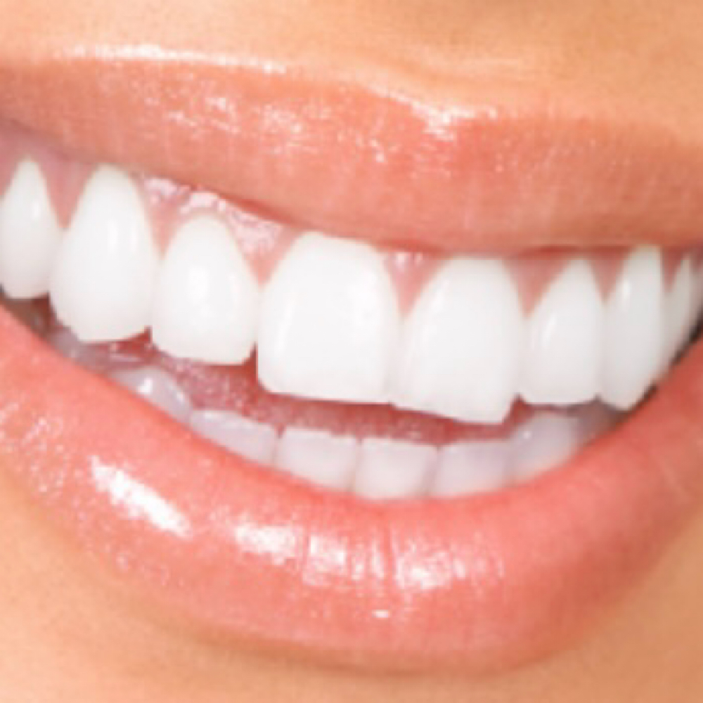 Olivia Waite at Sparkle Smile Spa LLC in Chandler, AZ