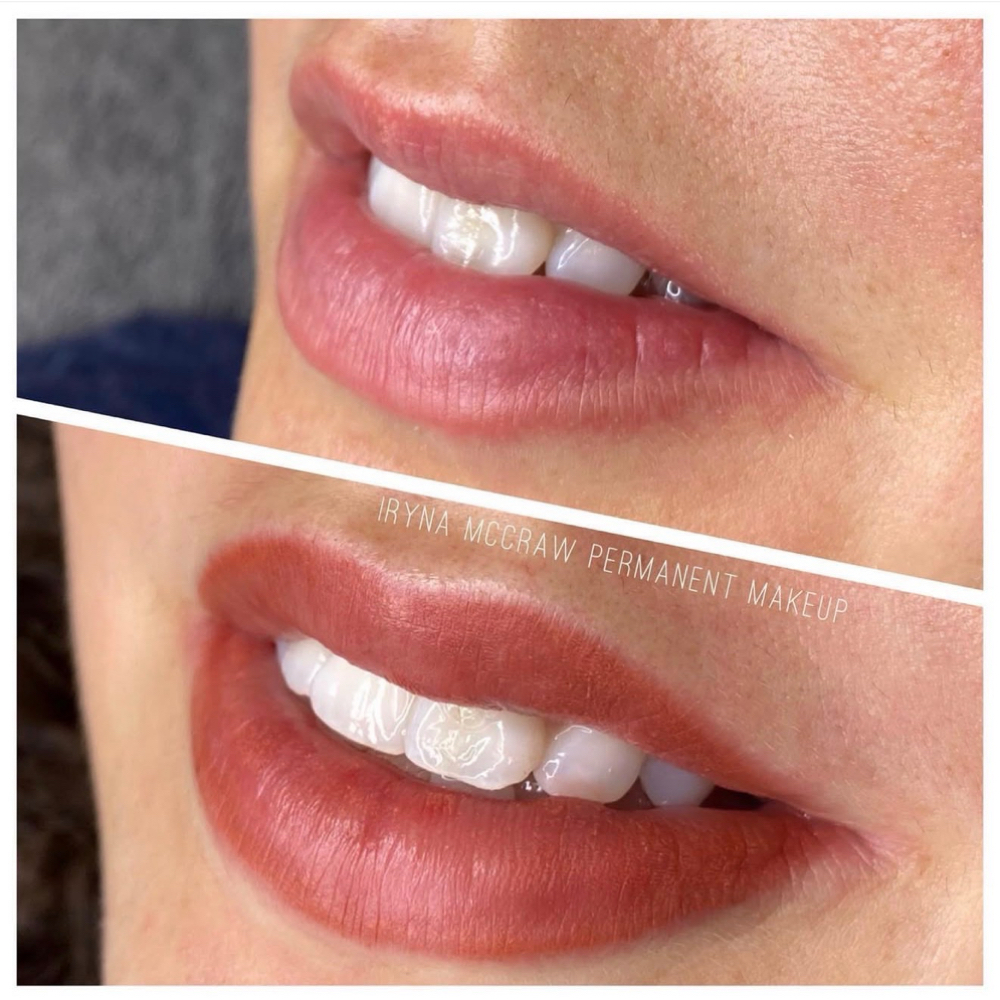 Iryna Mccraw at Marco Island Aesthetics in Marco Island,, FL
